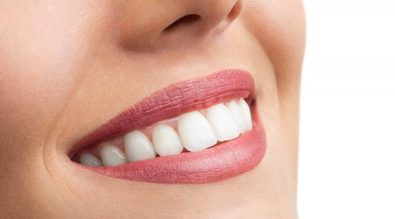 Our Picks for the Best Teeth Whitening Kits